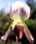 Paph callosum